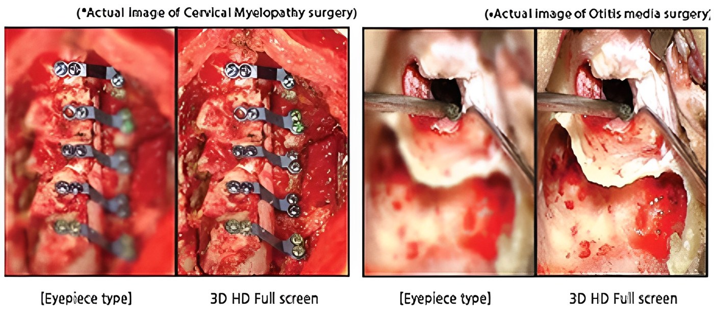 Surgical imaging comparison from Mediilife — contains surgical imagery
